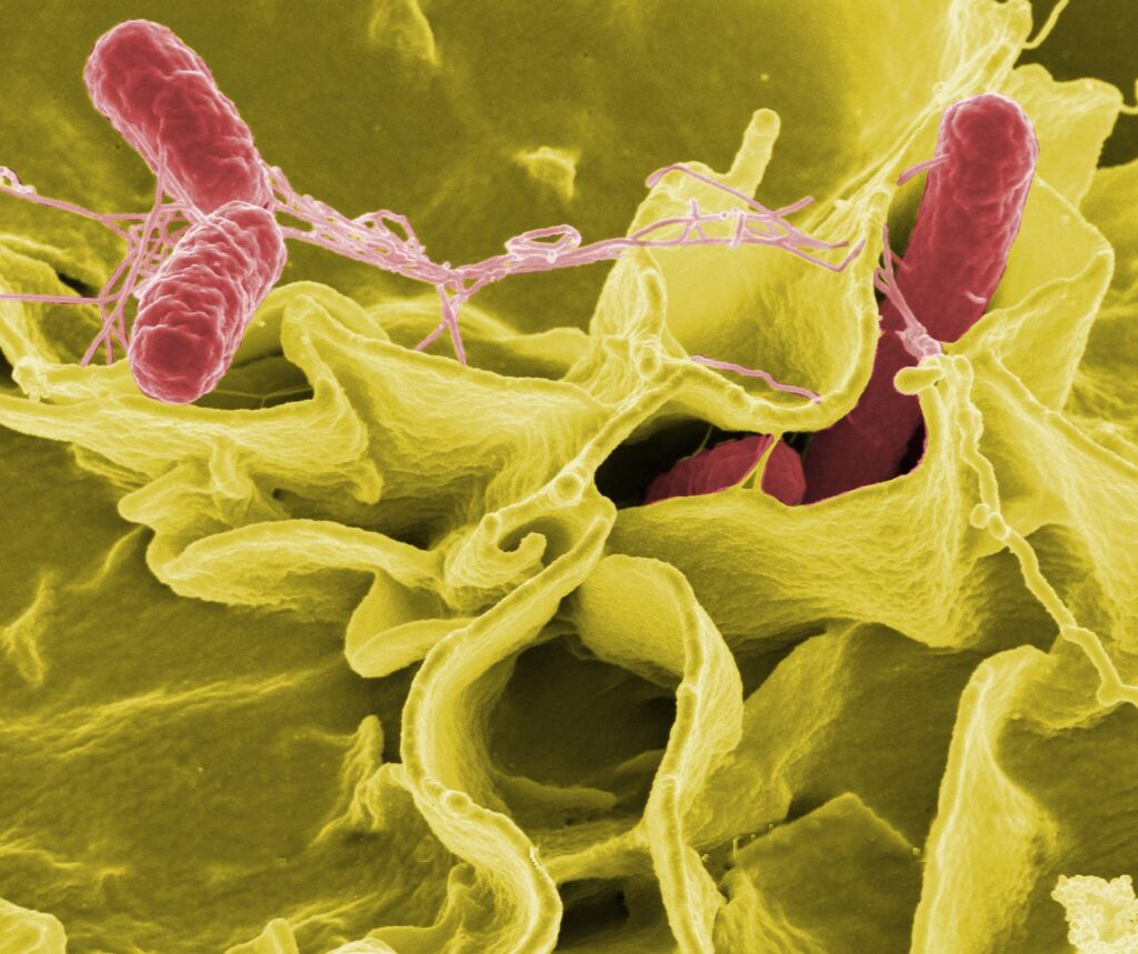 Urine Infection in 2025: You Should Know The Hidden Battle Inside Your Bladder