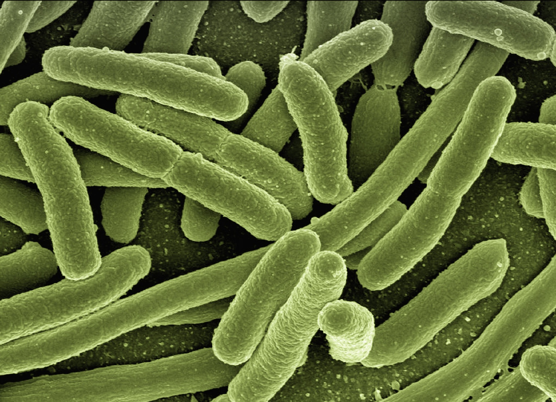 Urine and Uti Infection Bacteria Visualisation